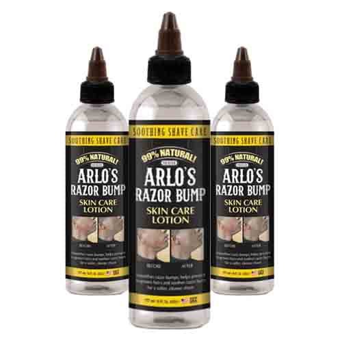 Arlo's Hautpflege Lotion gegen Rasierpickel – Beruhigend 177ml