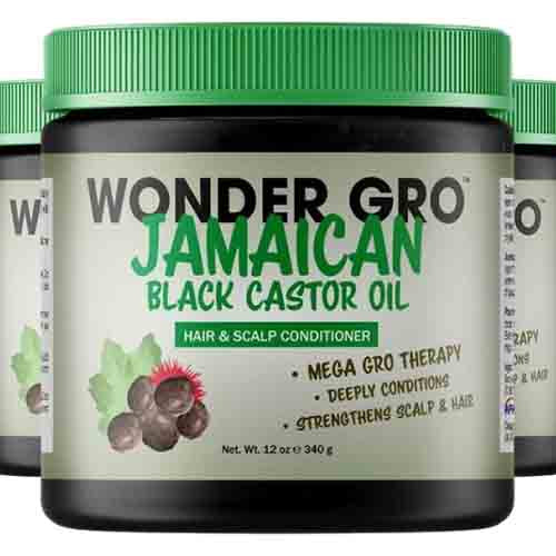 Wonder Gro Haar- und Kopfhaut Conditioner – Ultra-Feuchtigkeit 340g
